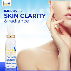 Fair and White Original Dark Spot Remover 30ml