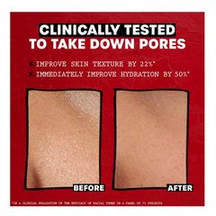 Thayers Alcohol-Free Witch Hazel Toner - Rose Petal