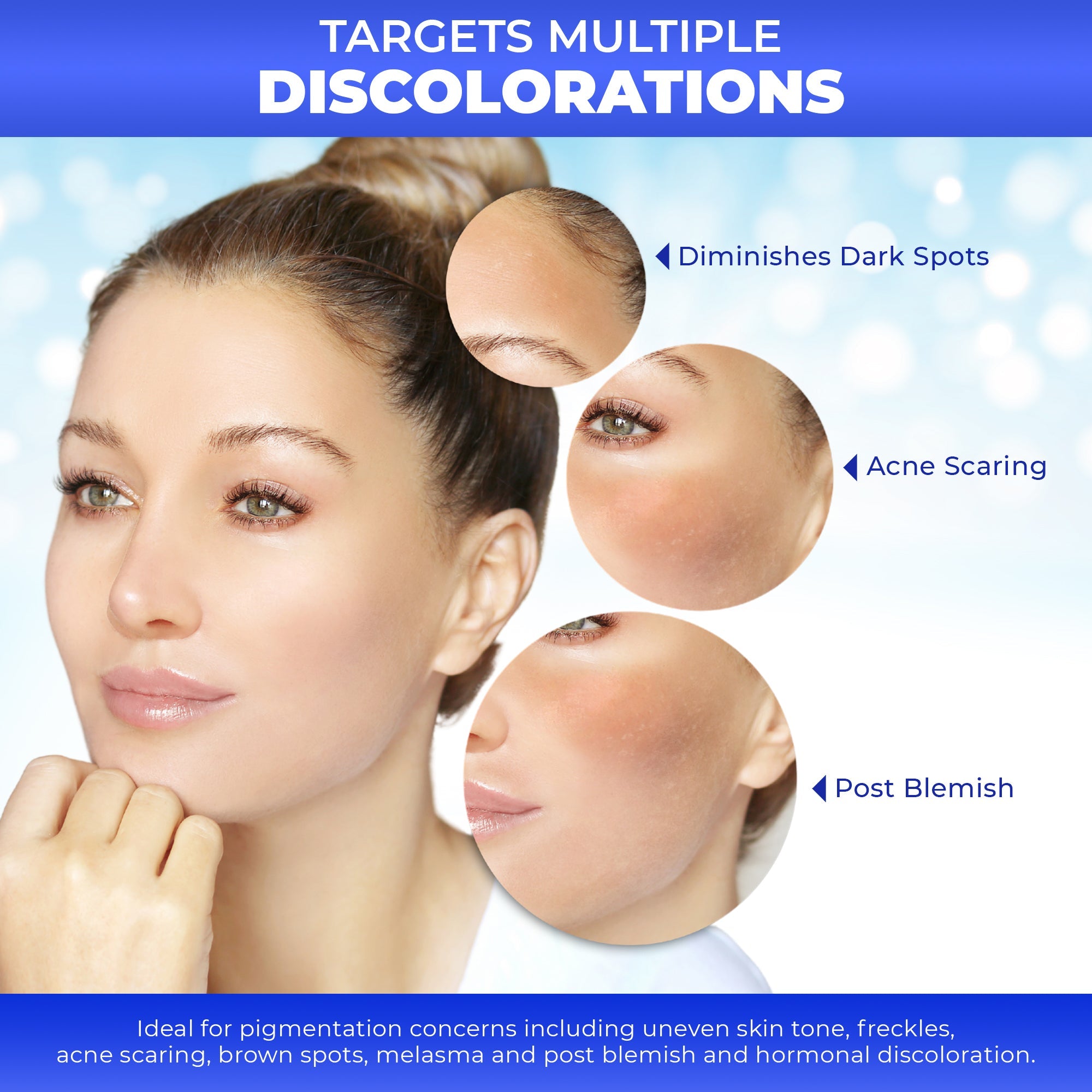 Fair and White Original Dark Spot Remover 30ml