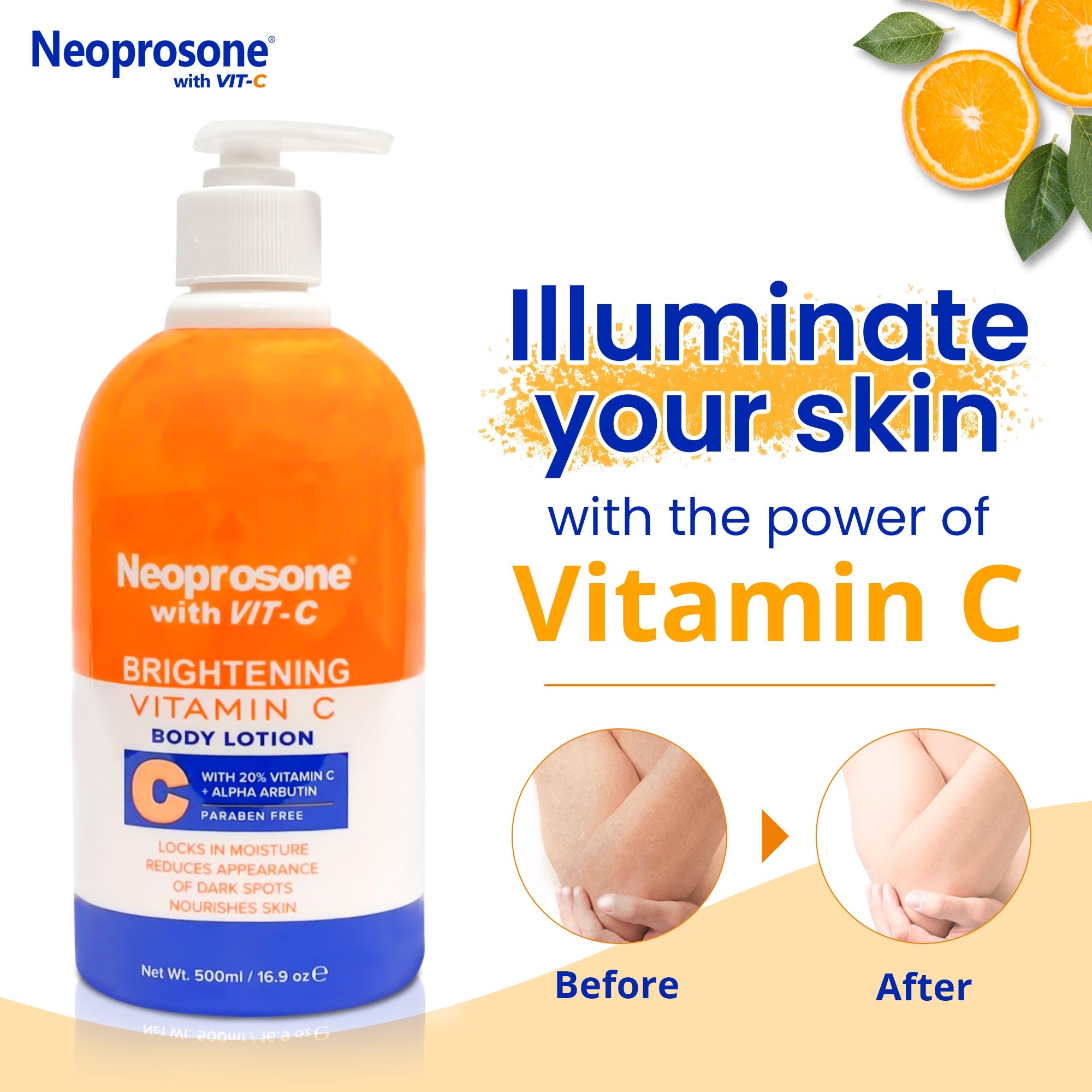 Neoprosone Brightening Body Lotion w/ Vitamin "C" (with pump) 500ml