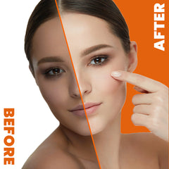 Neoprosone Brightening Gel with Vitamin "C" 30g