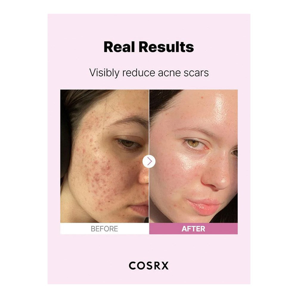 COSRX The Niacinamide 15 Serum (20ml)