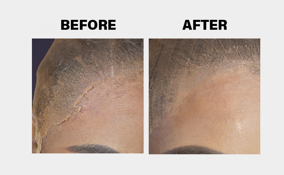 EBIN Wonder Lace Bond Melting Spray - Extreme Firm Hold Active 3.39oz