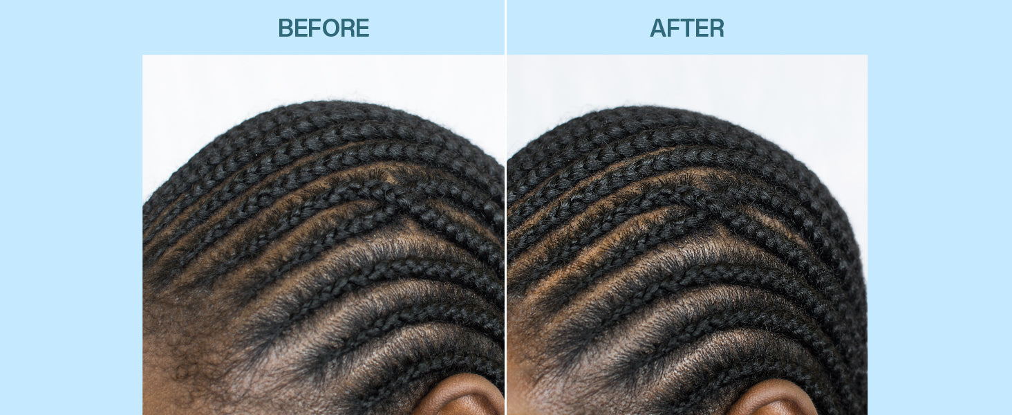 EBIN Braid Formula No-Rinse Cleansing Foam - Biotin