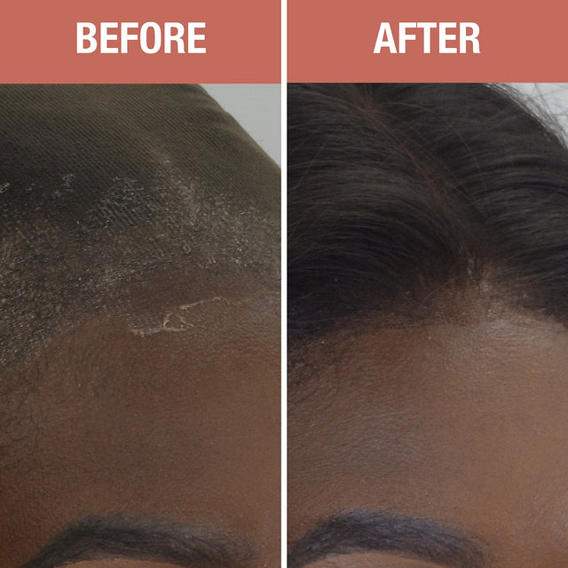 EBIN Wonder Lace Bond Glueless Lace Holding Spray