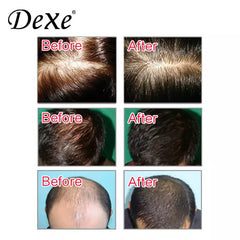 Dexe Anti-Hair Loss Shampoo
